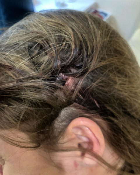 «Мне сломали нос!»: новосибирскую певицу избили в московском салоне красоты «Мне сломали нос!»: новосибирскую певицу избили в московском салоне красоты