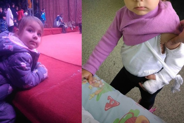 &laquo;Теперь мы в гипсе на месяц&raquo;: двухлетняя девочка покалечилась во время выступления бродячего цирка