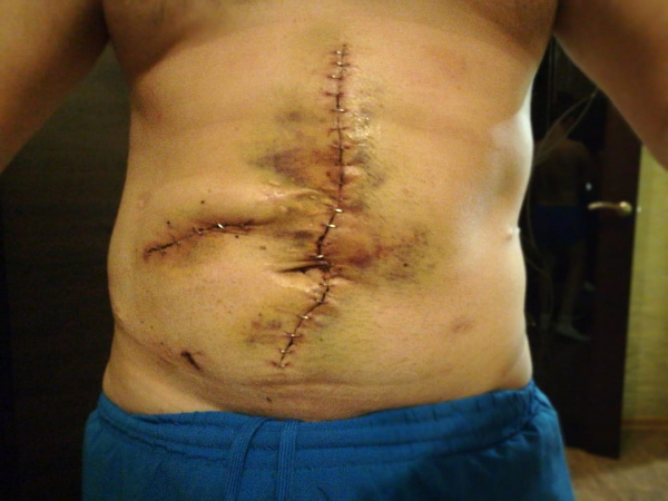 Отомстил за караоке: бизнесмен расстрелял соседа-айтишника в упор, но его не накажут Отомстил за караоке: бизнесмен расстрелял соседа-айтишника в упор, но его не накажут