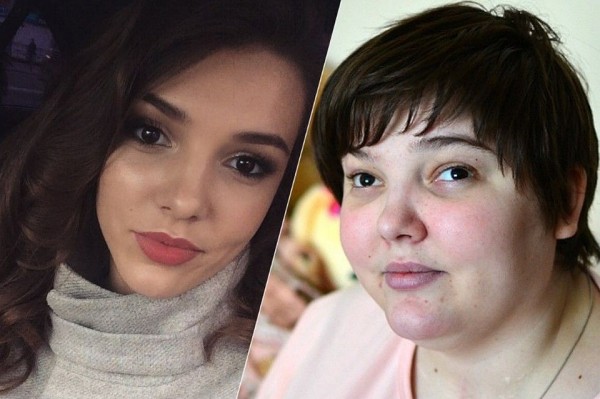 «Я его простила»: парень бросил девушку, которая ослепла и изменилась до неузнаваемости по его вине «Я его простила»: парень бросил девушку, которая ослепла и изменилась до неузнаваемости по его вине