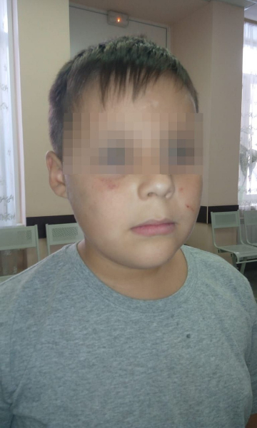 &laquo;Ах ты, свинья!&nbsp;Я тебя сейчас подпалю!&raquo;: четверо мальчишек жестоко избили третьеклассника