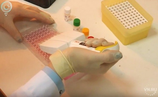 Рак распознают по капле крови новосибирские медики Рак распознают по капле крови новосибирские медики