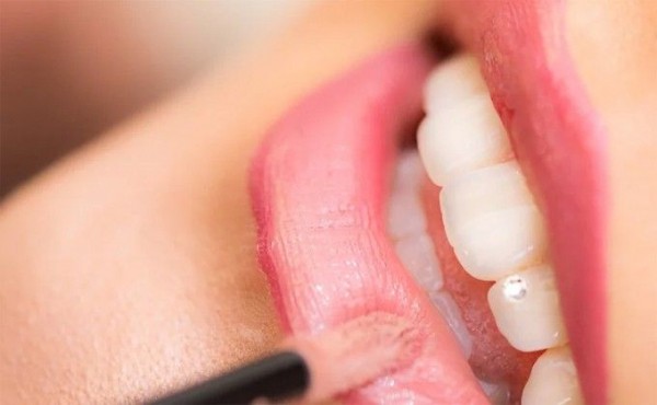 Увеличение губ «уколом красоты» изуродовало клиентку Увеличение губ «уколом красоты» изуродовало клиентку