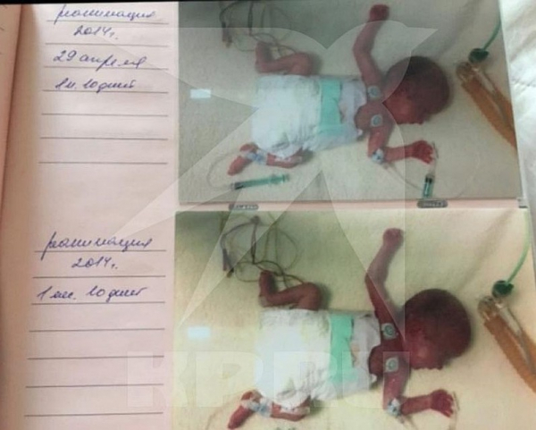 Опека попросила провести психиатрическую экспертизу папы и мамы, которые 5 лет не забирают дочь из больницы