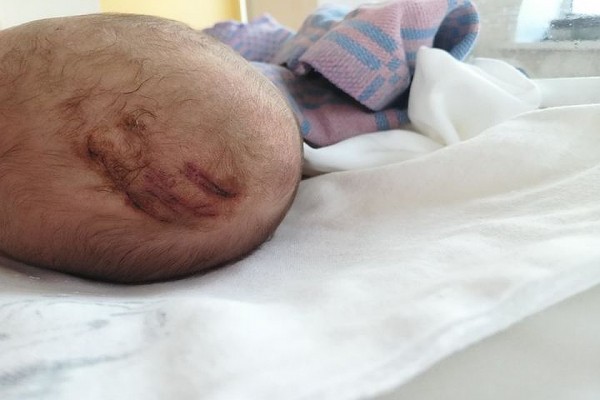 &laquo;Врач порезал сыну голову!&raquo;: сибирячка показала, каким ей выдали младенца после родов