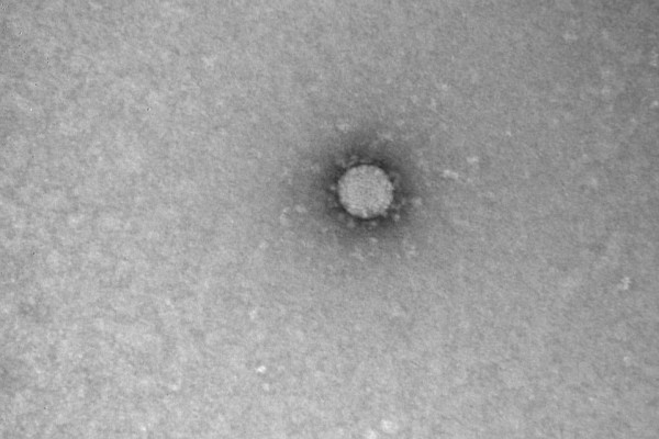 Маленький и опасный: в центре вирусологии «Вектор» сделали снимки китайского коронавируса Маленький и опасный: в центре вирусологии «Вектор» сделали снимки китайского коронавируса