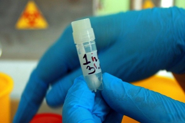 Коронавирус в Новосибирске, последние новости на 21 марта 2020 года: наши ученые испытывают вакцину на мартышках, а американцы — на трансгенных мышах Коронавирус в Новосибирске, последние новости на 21 марта 2020 года: наши ученые испытывают вакцину на мартышках, а американцы — на трансгенных мышах