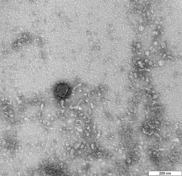 Коронавирус в Новосибирске, последние новости на 20 марта 2020 года: женщина привезла вирус из Италии и сама не поняла, что болеет