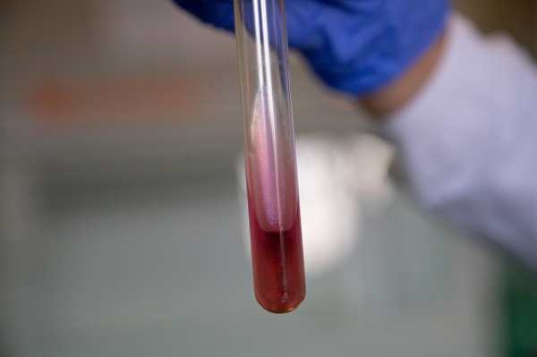 Симптомы коронавируса и гриппа: в чем разница? Симптомы коронавируса и гриппа: в чем разница?