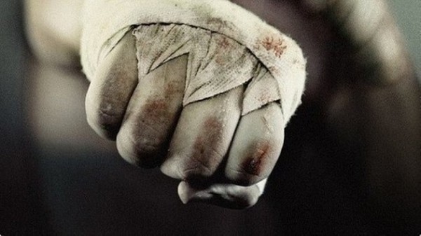 В Новосибирской области две девушки избили соседку и обезобразили ей нос