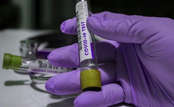 Первый случай заражения коронавирусом в Куйбышевском районе &ndash; подробности