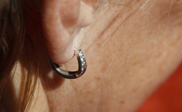 Женщине оторвали ухо за испорченные сандалики в Бердске Женщине оторвали ухо за испорченные сандалики в Бердске