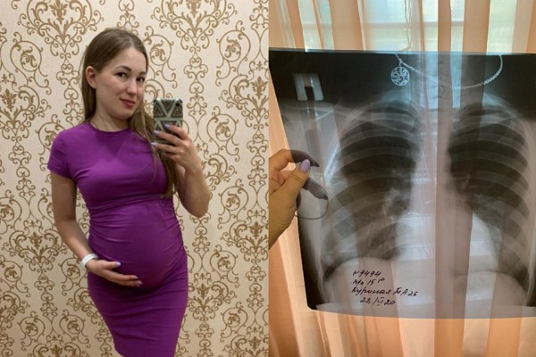 Врачи выпустили с карантина беременную сибирячку с COVID-19 из-за путаницы с результатами теста Врачи выпустили с карантина беременную сибирячку с COVID-19 из-за путаницы с результатами теста