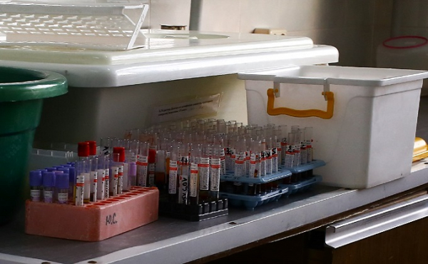 Как делают ПЦР-анализ на коронавирус: показываем все стадии