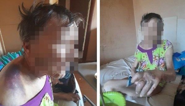 Сын-зэк мог избивать и морить голодом мать-пенсионерку Сын-зэк мог избивать и морить голодом мать-пенсионерку