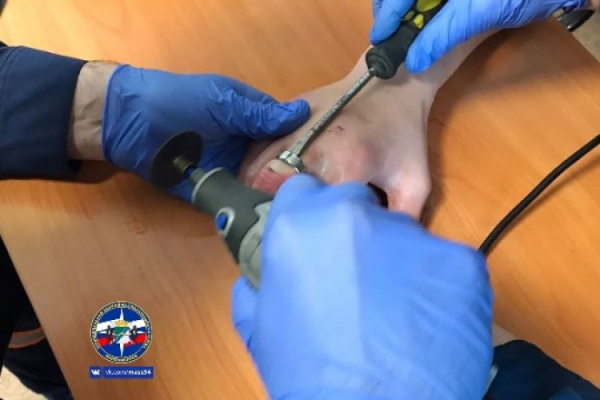 Кольца с опухших пальцев не смогли снять новосибирские мужчины